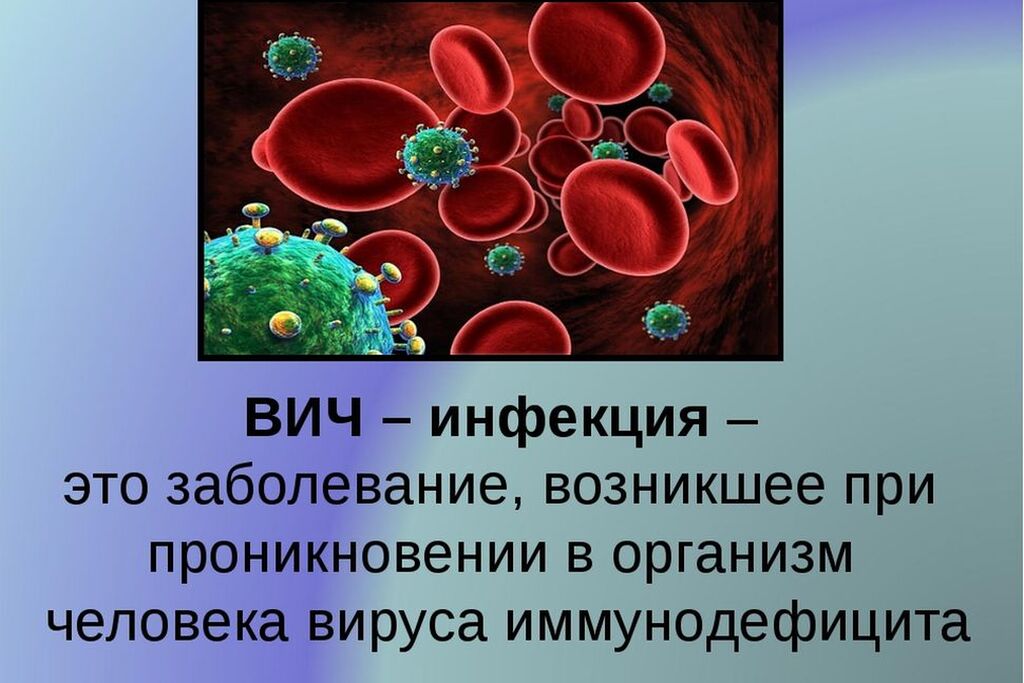 Каковы пути заражения человека вирусом иммунодефицита. ВИЧ инфекция. Вичиняекция. ВИЧ инфекция картинки.
